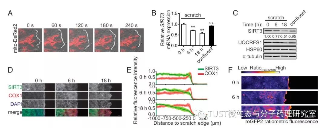线粒体去乙酰酶SIRT3抑制Src/FAK信号通路、阻碍癌症细胞迁移(图1)