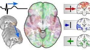中年时期的肥胖会增加患阿尔茨海默病的风险？(图4)