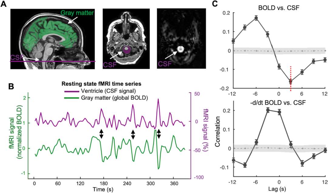 睡眠依赖性低频全脑活动可清除阿尔茨海默病相关毒素积聚！(图3)