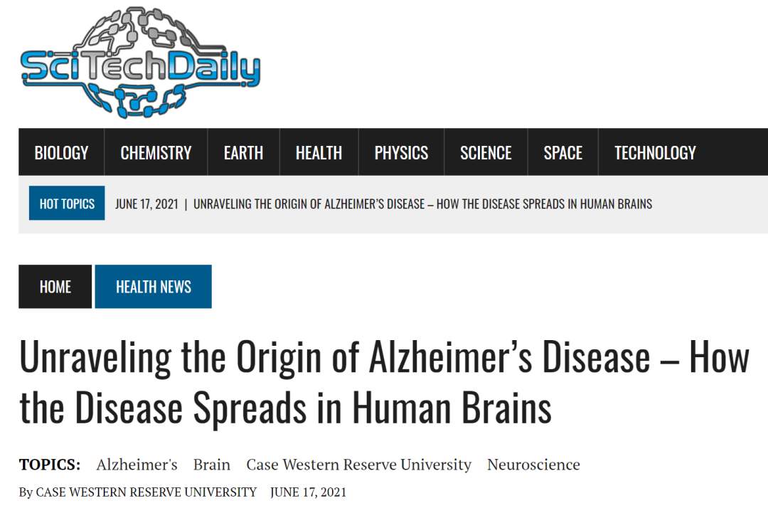 阿尔茨海默病是如何在人脑中传播的？(图1)