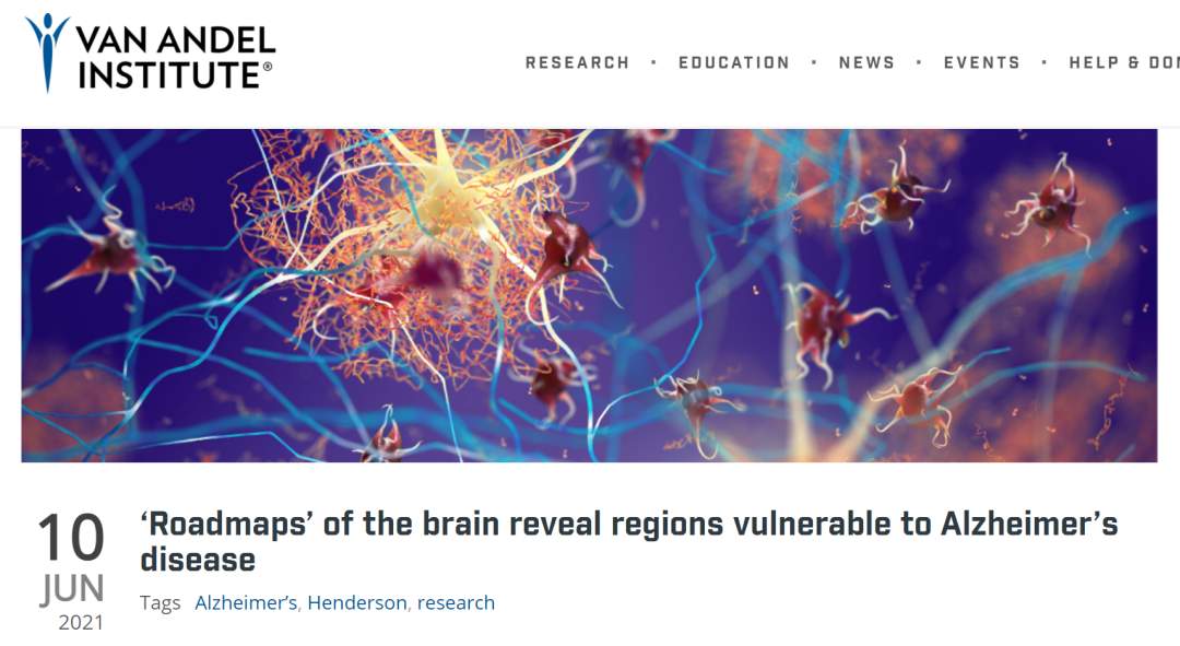 《科学进展》：大脑“路线图”揭示患阿尔茨海默病区域(图1)