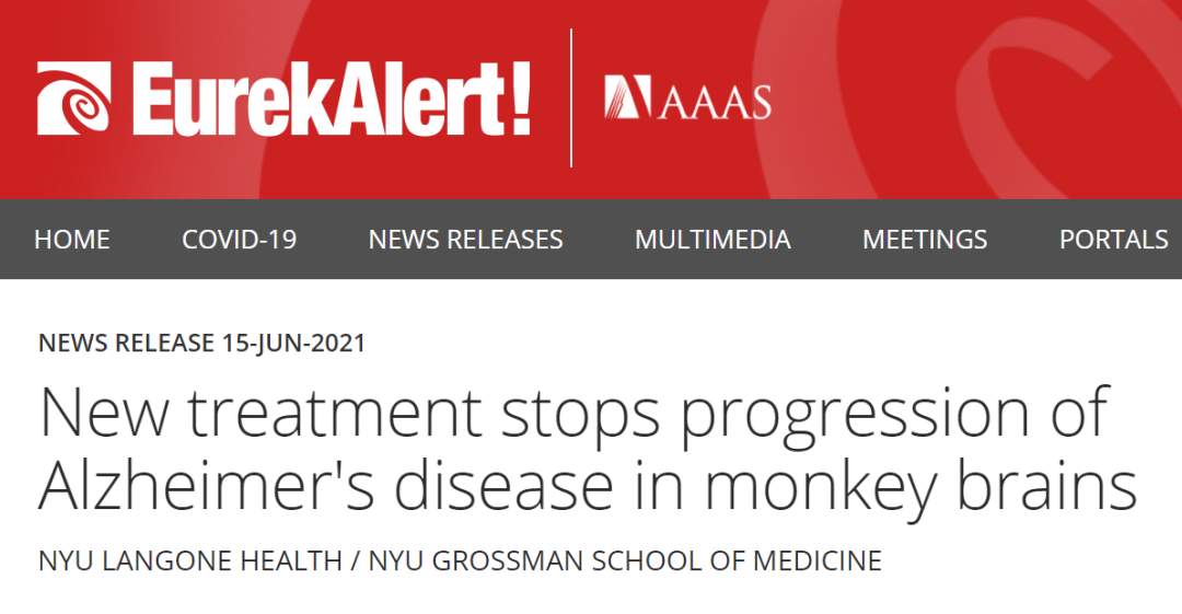 纽约大学医学院新疗法，可有效延缓阿尔茨海默病进展(图1)