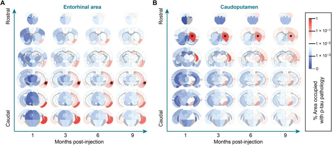 《科学进展》：大脑“路线图”揭示患阿尔茨海默病区域(图3)