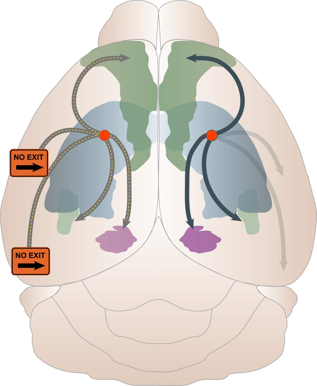 《科学进展》：大脑“路线图”揭示患阿尔茨海默病区域(图4)