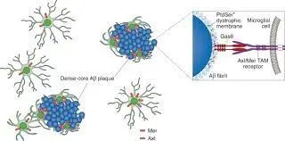 《自然－免疫学》：一些阿尔茨海默病的斑块可能是保护性的(图3)