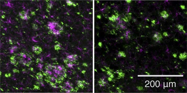 新药物发现：可安全有效的预防阿尔茨海默病(图4)