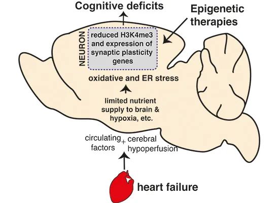 《EMBO分子医学》：心脏病患者患痴呆症风险会增加(图3)