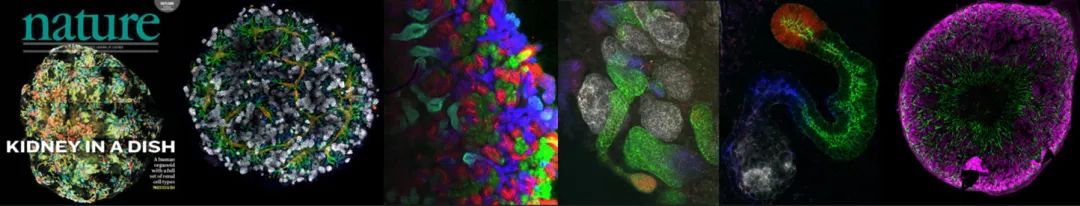 研究人员对人体的微型肾脏进行生物3D打印(图1)