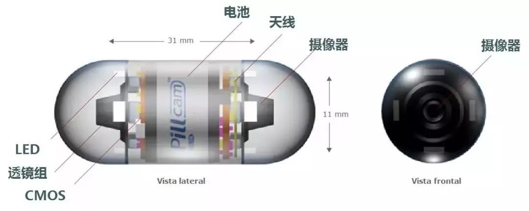 胶囊扫描系统或成结直肠癌筛查新突破(图3)