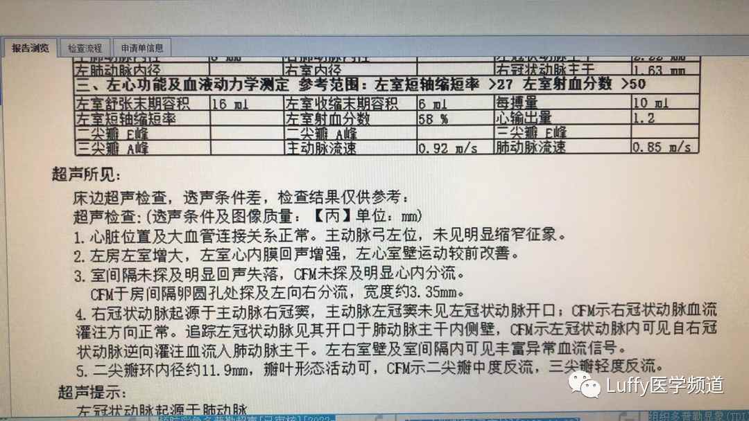 【儿科专场】冠状动脉起源肺动脉畸形(图1) 【儿科专场】冠状动脉起源肺动脉畸形(图1)