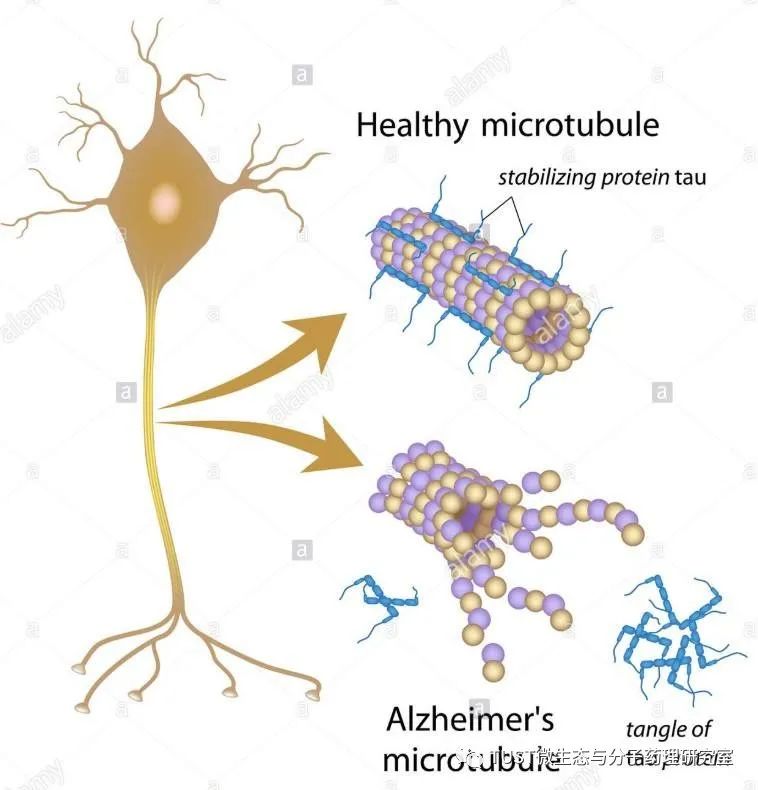 液-液相分离会诱导致病性Tau构象形成,促进老年痴呆的发生(图1) 液-液相分离会诱导致病性Tau构象形成,促进老年痴呆的发生(图1)