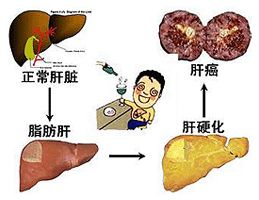 黄连素的酒精性肝病治疗作用与诱导免疫抑制细胞及调节肠道微生态有关(图1) 黄连素的酒精性肝病治疗作用与诱导免疫抑制细胞及调节肠道微生态有关(图1)
