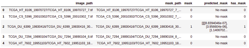 使用深度学习进行脑肿瘤检测和定位：Part2(图2)