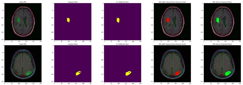 使用深度学习进行脑肿瘤检测和定位：Part2(图4)