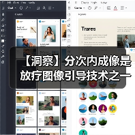 【洞察】分次内成像是放疗图像引导技术之一 市场发展空间大(图2) 【洞察】分次内成像是放疗图像引导技术之一 市场发展空间大(图2)